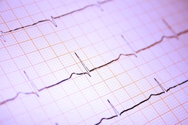 Do lượng máu hạn chế thì cơ thể căng thẳng và phải làm cho nhịp tim được phối hợp. Bạn hãy đi chụp điện tâm đồ để có thể nhận thấy được trái tim của bạn có làm việc chuẩn hay không.