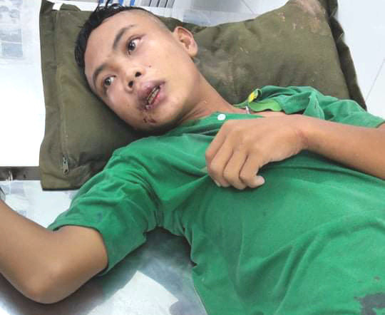 Cả trăm đối tượng buôn lậu cầm gậy vây đánh lực lượng biên phòng và công an - Hình 2 Ca tram doi tuong buon lau cam gay vay danh luc luong bien phong va cong an-Hinh-2