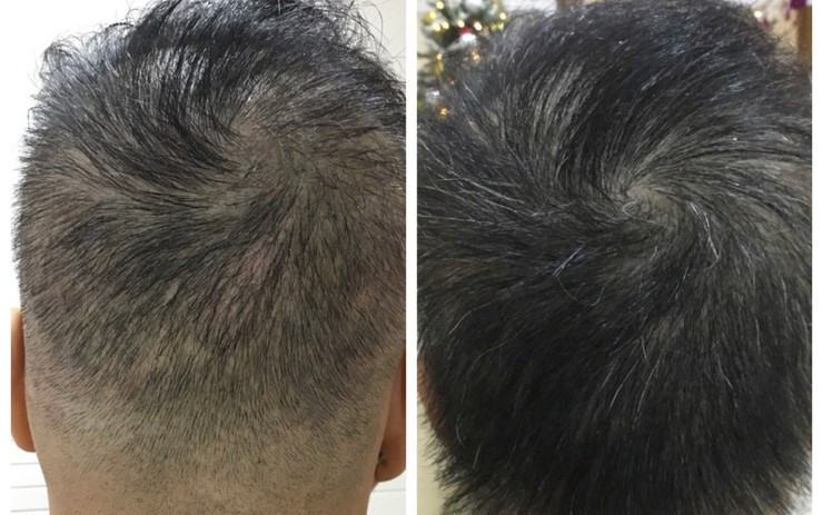  15. Tốc độ phát triển của tóc liên quan đến sắc tộc. Tóc của con người thường dài ra trung bình 15 cm/năm, nhưng tốc độ phát triển thực tế của tóc sẽ có sự khác biệt ở các sắc tộc. Tóc của người châu Á có xu hướng dài nhanh hơn những sắc tộc khác. 