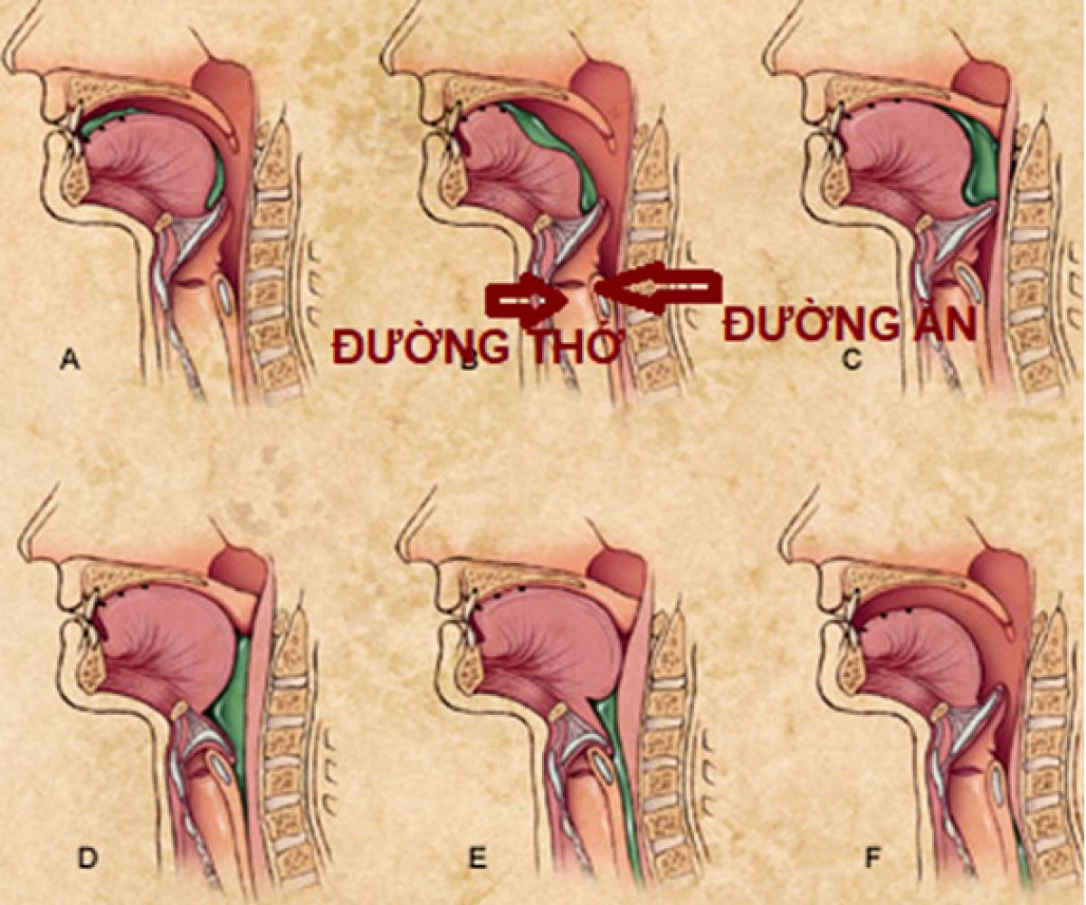  6. Bạn không thể thở và nuốt cùng một lúc. Thức ăn, nước uống chúng ta nuốt và không khí chúng ta hít vào đều đi xuống cùng một phần của cổ họng. Nếu khí quản và thực quản mở ra cùng một lúc, không khí sẽ tràn vào bao tử, còn thức ăn sẽ rơi vào phổi. 