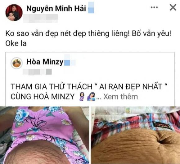 Hau thua nhan tan vo, dan mang xot xa vet ran cua Hoa Minzy-Hinh-5