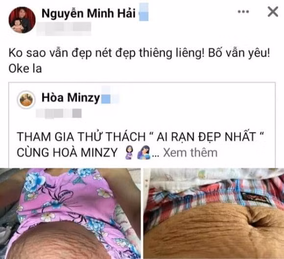 Hau thua nhan tan vo, dan mang xot xa vet ran cua Hoa Minzy-Hinh-5