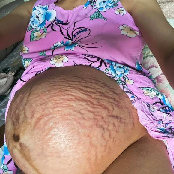 Hau thua nhan tan vo, dan mang xot xa vet ran cua Hoa Minzy-Hinh-3