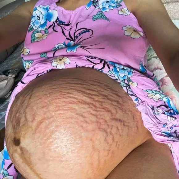 Hau thua nhan tan vo, dan mang xot xa vet ran cua Hoa Minzy-Hinh-3