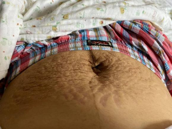 Hau thua nhan tan vo, dan mang xot xa vet ran cua Hoa Minzy-Hinh-2