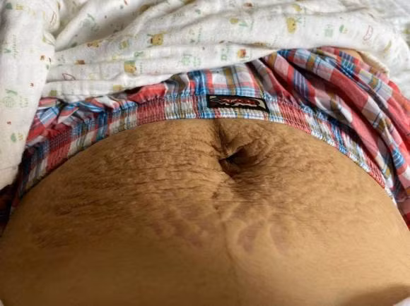 Hau thua nhan tan vo, dan mang xot xa vet ran cua Hoa Minzy-Hinh-2