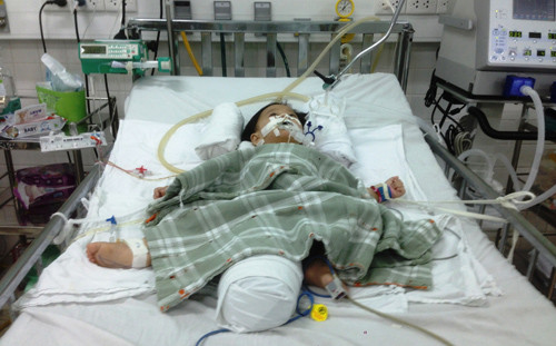 Trước đó, chị Cẩm đi chơi với người tình tên là H. (30 tuổi), có đem bé Hân đi cùng. Sau 2 ngày không thấy chị Cẩm đưa bé Hân về, bà ngoại và các cậu của bé Hân đến nhà H. tìm thì đúng lúc Cẩm ôm con ra đón taxi đưa vào bệnh viện cấp cứu trong tình trạng hôn mê, đầu chấn thương nặng, người bị phù, xuất huyết não. Hiện công an đang điều tra bé Hân nguy kịch có phải do người tình của mẹ ruột đánh đập hay không.