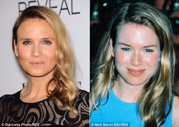 So sánh khuôn mặt hiện tại của Renee (trái) và khuôn mặt cô năm 1998 thấy rõ sự khác biệt và như hai người khác nhau. Khuôn mặt của “tiểu thư Jones” trông khác hẳn so với trước, trán không một vết nhăn, lông mày biến đổi, khuôn mặt bỗng sưng lên trông thấy.