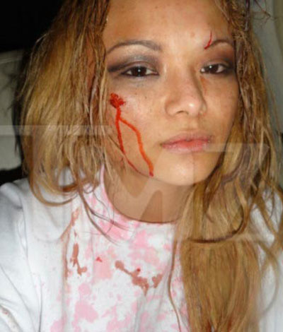 Ngôi sao người Mỹ gốc Việt Tila Tequila đang biểu diễn trên sân khấu sự kiện Juggalo thì liên tiếp bị nép chai bia, đá vào người và hậu quả là mặt mũi chảy máu tùm lum.