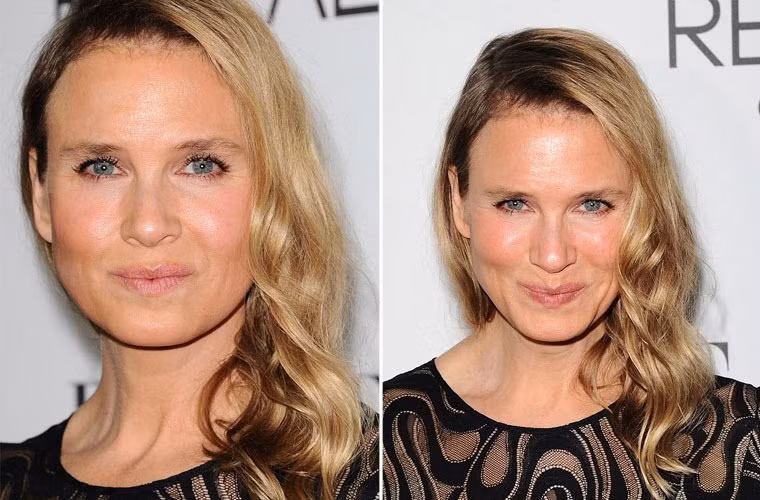 Bạn có nhận ra đây là Renee Zellweger. Nhưng đó lại chính là hình ảnh mới nhất của cô khi xuất hiện tại một sự kiện do Elle tổ chức hôm 20/10/2014.