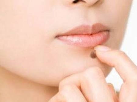 Nốt ruồi ở cằm: Theo nhân tướng học, nốt ruồi trên cằm chủ nhân về ruộng vườn, nhà cửa… là nốt ruồi tốt. Chủ nhân dễ trở nên giàu có.