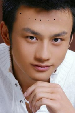 Nốt ruồi trên trán: Trán thể hiện sự phúc đức của con người. Theo hình trên, từ trái sang phải thứ tự các nốt ruồi bao gồm: nốt ruồi Điền Trạch, nốt ruồi Phú Quý, nốt ruồi Cát Tường, nốt ruồi Cát Tường, nốt ruồi Điền Trạch, nốt ruồi Quan Lộc, nốt ruồi Phú Quý. Nếu như trên trán phía gần chân tóc xuất hiện nốt ruồi đen bóng đồng thời Thiên Đình đầy đặn thì rất tốt. Thực tế, nó cũng thể hiện chủ nhân xuất thân trong gia đình tương đối sung túc. Thế nhưng, nốt ruồi màu đen nâu thì lại không tốt.