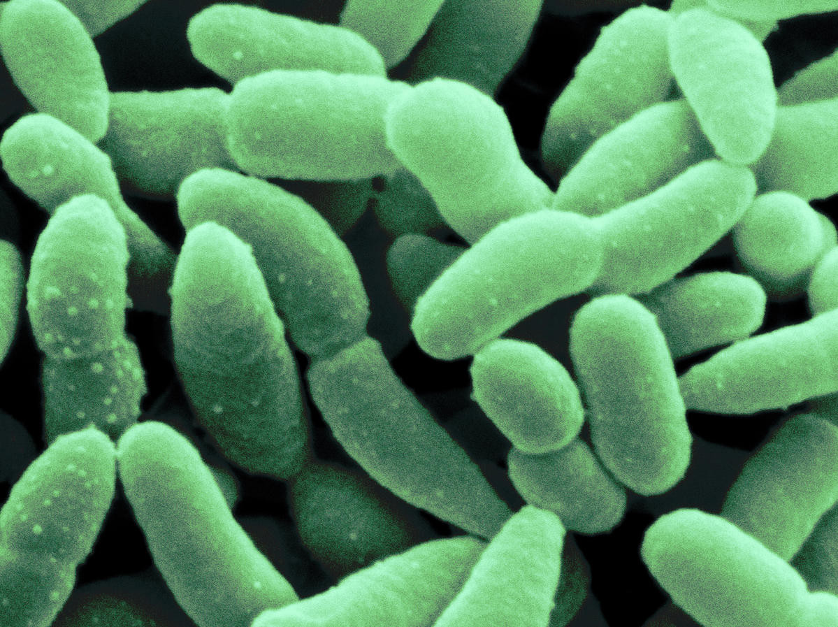 Vi khuẩn Acetobacter aceti dài 1-4 µm, thường được dùng để sản xuất giấm. Chúng cũng có thể là tác nhân gây hại thường xuất hiện trong quá trình lên men đồ uống có cồn, đặc biệt là làm bia bị chua và đổi màu.