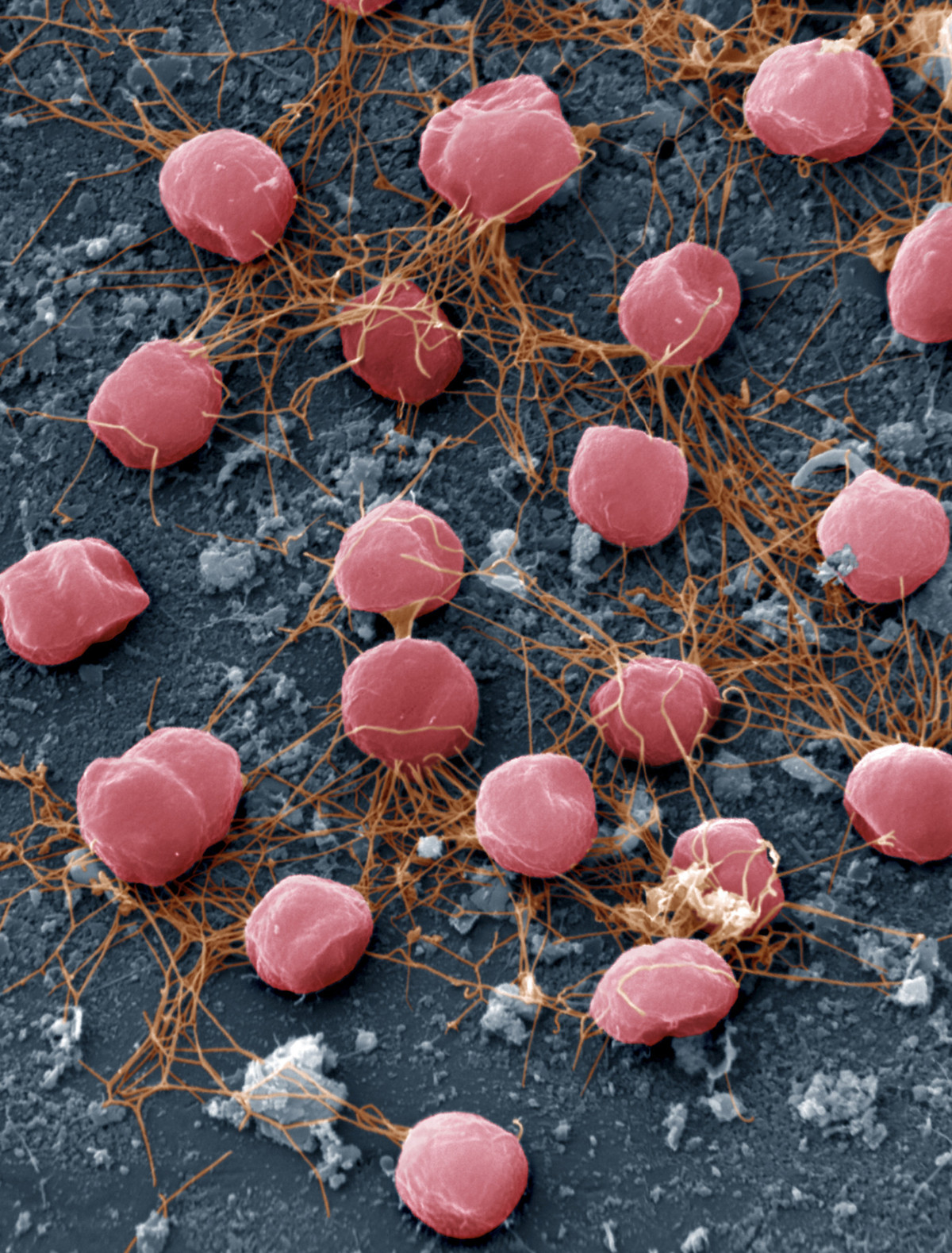 Cổ khuẩn Pyrococcus furiosus có đường kính 0,8-2 µm. Tên gọi "Pyrococcus" của chúng có nghĩa là quả cầu lửa, phán ánh hình dạng và khả năng chịu nhiệt cực cao: Loài cổ khuẩn này phát triển tốt nhất ở 100 độ C - nhiệt độ sôi của nước.
