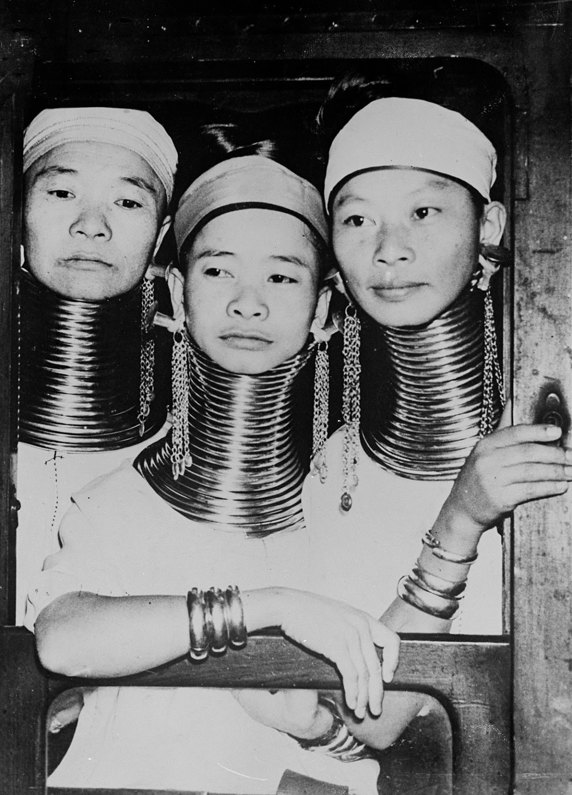 Những người phụ nữ phụ nữ tộc " người cổ dài" Padaung trên tàu hỏa, khi họ đến ga Victoria ở London năm 1935. Phụ nữ Padaung đeo vòng bằng đồng từ khi nhỏ. Theo thời gian, số vòng được tăng lên dần dần, các đốt sống cổ bị kéo dãn làm chiếc cổ trở nên dài bất thường.