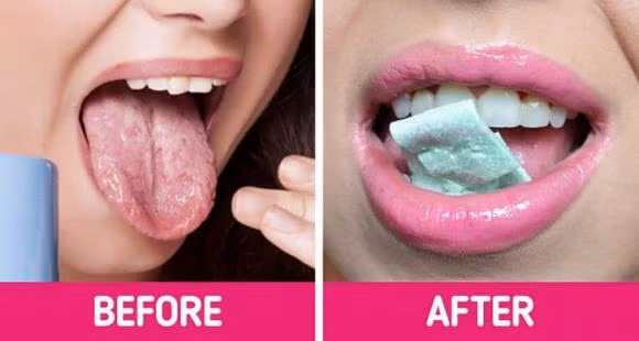 An lau, nuong nhieu bi bong rat luoi va 10 cach chua lanh cap toc-Hinh-4