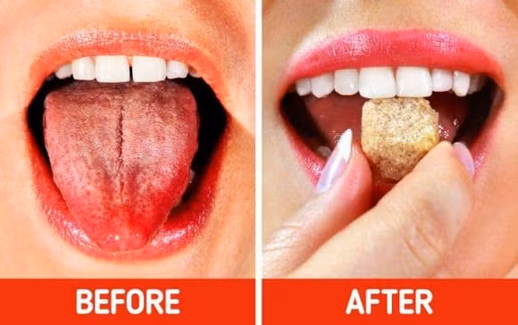 An lau, nuong nhieu bi bong rat luoi va 10 cach chua lanh cap toc-Hinh-6