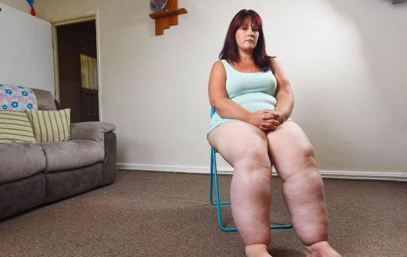 Co benh ung thu trong co the, co the thuong co nam dau hieu-Hinh-2