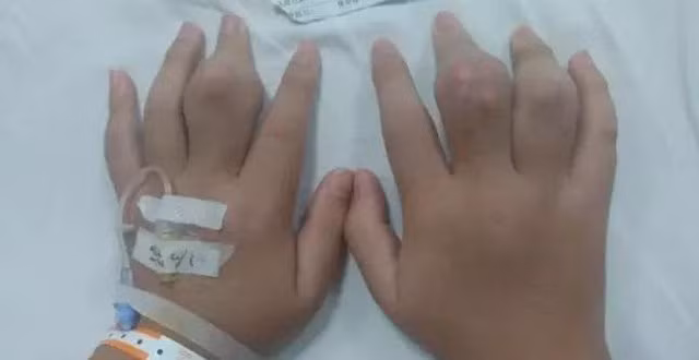 Uong tra sua 2 ngay mot coc, thanh nien 18 tuoi noi u o tay chan-Hinh-2