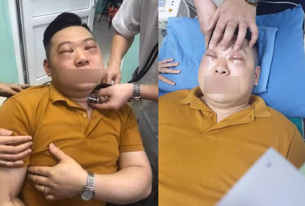 Soc phan ve nang sau khi thai mot cu hanh