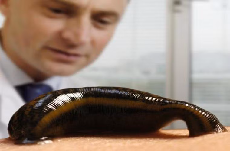  Đỉa. Chúng thường sống nhiều ở nơi có nước. Khi hút máu, đỉa tiết ra chất chống đông máu, và nhờ lý do này chúng được dùng để chữa bệnh cho các bệnh nhân bị máu đông.