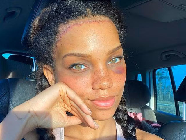 Co gai chi tien khung de phau thuat che giau vang tran “san bay”