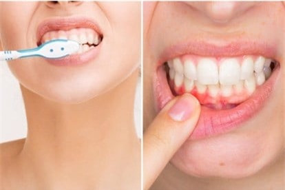 Bộ phận trên cơ thể được vệ sinh hàng ngày mà lạ thay vẫn “hôi” ảnh 2 Bộ phận trên cơ thể được vệ sinh hàng ngày mà lạ thay vẫn “hôi” ảnh 2