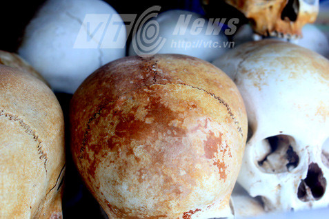 Hộp sọ với những vết nứt đều nhau của những nạn nhân bị sát hại bởi gậy gỗ mun.