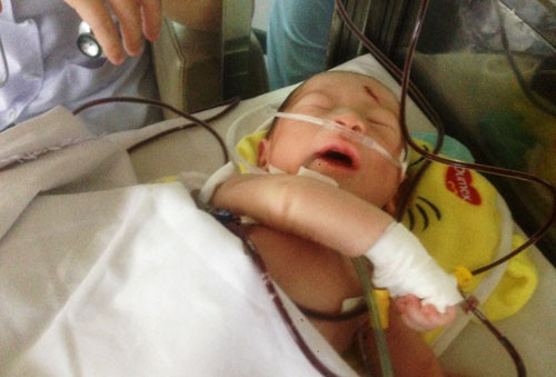 Cháu bé đáng thương tại BV Nhi đồng 1, TP HCM.