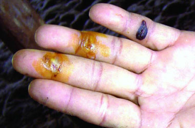 Ảnh minh họa. Ảnh minh họa.