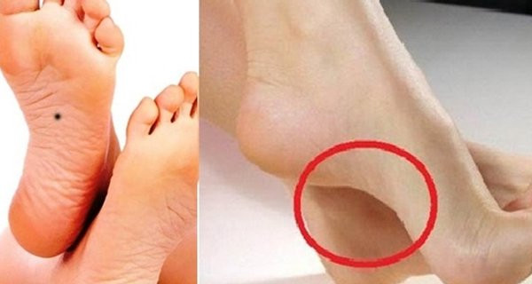 Nhìn tướng bàn chân biết ngay ai sang giàu, ai nghèo khó Nhin tuong ban chan biet ngay ai sang giau, ai ngheo kho