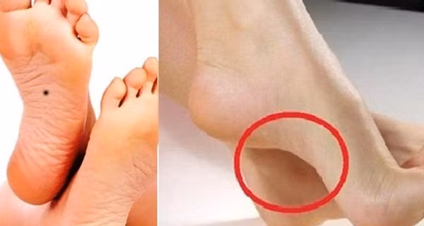 Nhin tuong ban chan biet ngay ai sang giau, ai ngheo kho