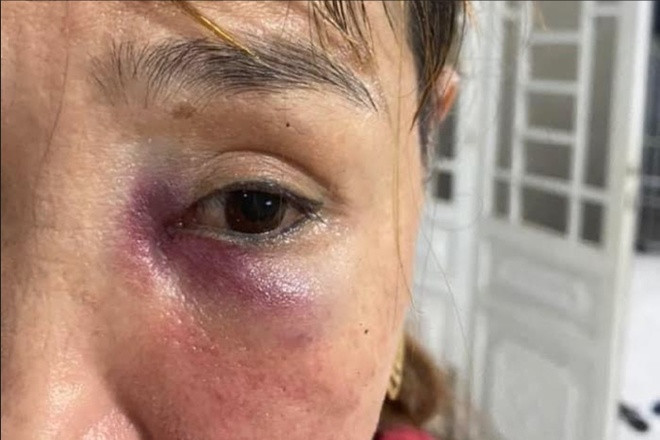 Nu chu quan mi Quang bi hanh hung bam tim mat