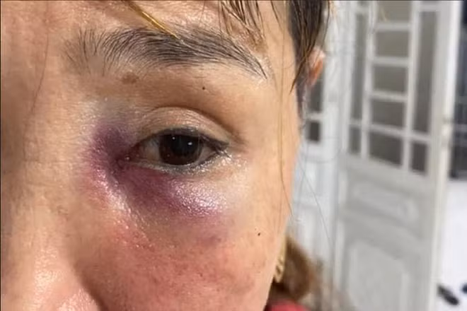 Nu chu quan mi Quang bi hanh hung bam tim mat