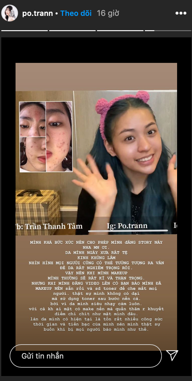 Hotgirl “trung ran can mo” can dam cong khai mat moc-Hinh-2