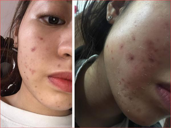 Hotgirl “trung ran can mo” can dam cong khai mat moc-Hinh-3