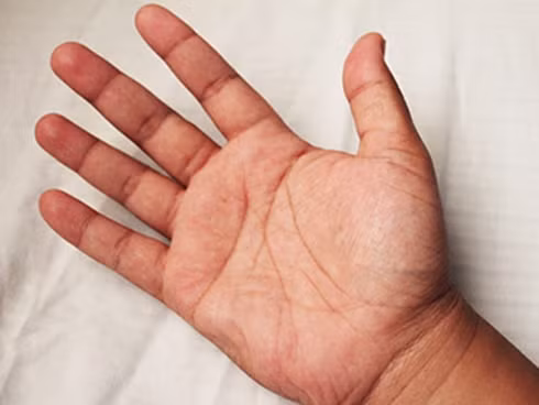 Nhin ban tay biet ngay nguoi do co so lam quan hay khong