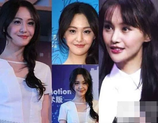 Kể từ đó, Trịnh Sảng liên tục xuất hiện với nhan sắc thất thường. Thậm chí có nhiều lần, gương mặt cô cứng đờ, méo xệch khiến người hâm mộ không khỏi lo lắng. Nữ diễn viên bị cho là nghiệm thẩm mỹ. Cho đến nay, thỉnh thoảng Trịnh Sảng vẫn bị gièm pha khi xuất hiện với chiếc mũi nhọn hoắt.