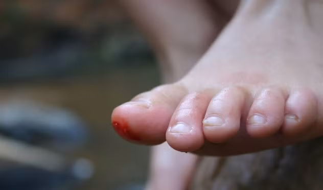 Azeman là một loài ma cà rồng của đất nước Nam Mỹ Surinam. Con ma này có hình dạng của một bà già vào ban ngày, khi đêm xuống sẽ hóa thành một loài vật, thường là dơi, để bay đi kiếm ăn. Nó sẽ tìm kiếm những người đang ngủ và hút máu của họ từ ngón chân cái. Nạn nhân sẽ không chết, nhưng sẽ trở nên yếu ớt và dễ mắc bệnh.