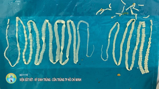 Hai con san day dai tong cong 4 m song trong bung nguoi dan ong