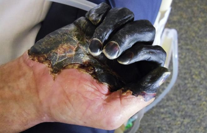 Mặc dù dùng đến cả chiến thuật độc địa nhất, nhưng Đại hãn Jani Beg không giành chiến thắng. “Cái chết đen” không chỉ tấn công kẻ địch, mà còn hủy hoại chính đội quân của ông, thành ra “lưỡng bại câu thương”.