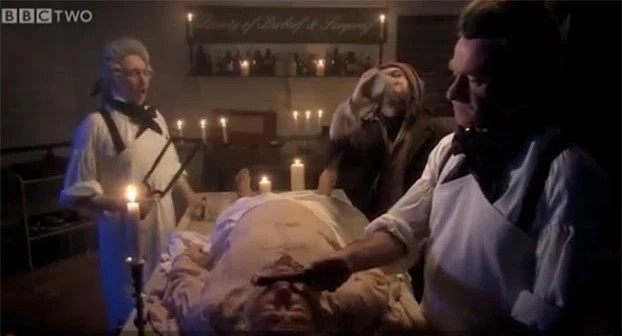 5. Rút máu để trị bệnh: Tại châu Âu, đến tận thế kỉ XX, nhiều quốc gia vẫn cho rằng rút bớt máu trong cơ thể có thể chữa bệnh. Nhưng hành động này chẳng những không giúp lợi gì, còn làm sức khỏe bệnh nhân suy giảm do mất quá nhiều máu.