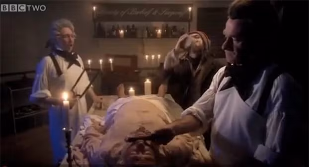 5. Rút máu để trị bệnh: Tại châu Âu, đến tận thế kỉ XX, nhiều quốc gia vẫn cho rằng rút bớt máu trong cơ thể có thể chữa bệnh. Nhưng hành động này chẳng những không giúp lợi gì, còn làm sức khỏe bệnh nhân suy giảm do mất quá nhiều máu.