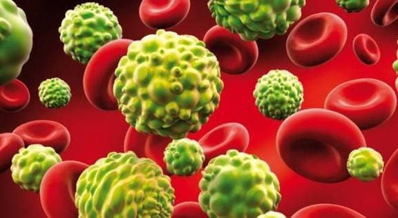 Co bi ung thu hay khong thi co the co the da 'thong bao'