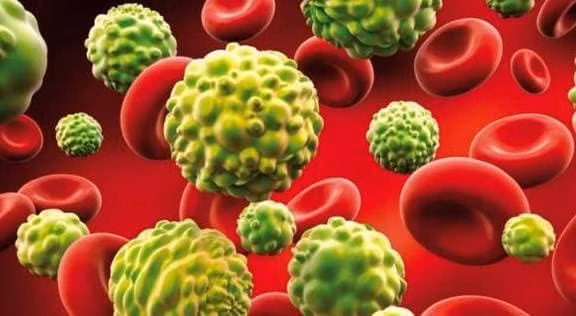 Co bi ung thu hay khong thi co the co the da 'thong bao'