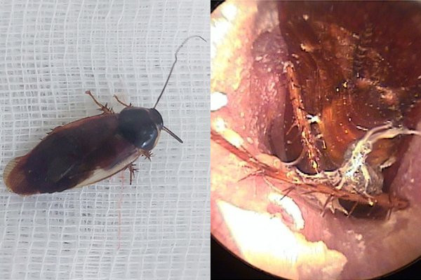 Nguoi dan ong phat hien con gian ngoe nguay trong tai sau giac ngu