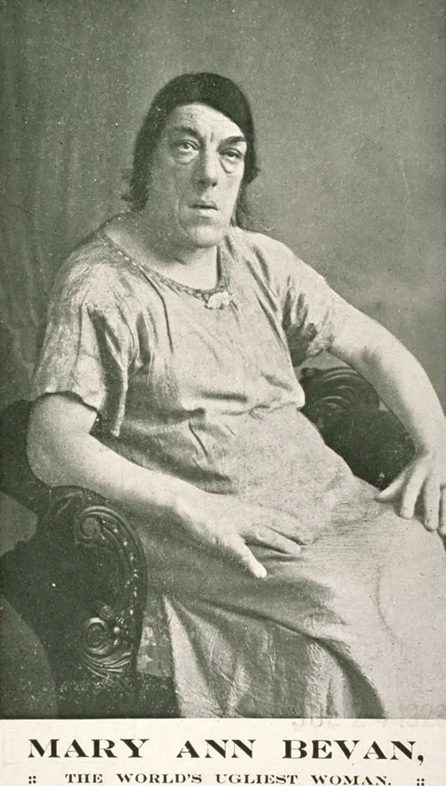 Ảnh hiếm và bi kịch của người phụ nữ xấu xí nhất thế giới - Hình 4 Anh hiem va bi kich cua nguoi phu nu xau xi nhat the gioi-Hinh-4