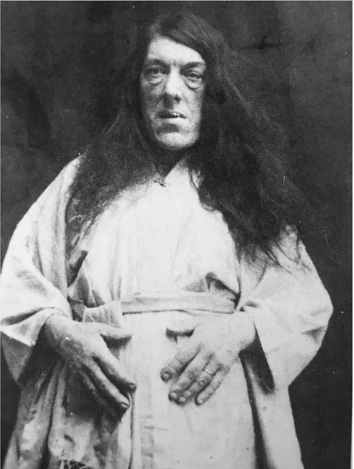 Ảnh hiếm và bi kịch của người phụ nữ xấu xí nhất thế giới - Hình 2 Anh hiem va bi kich cua nguoi phu nu xau xi nhat the gioi-Hinh-2