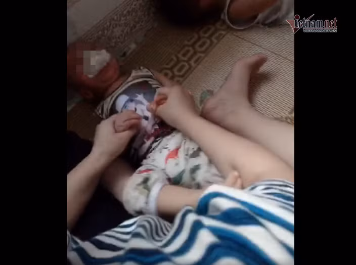 Bo chau be bi nhet gie vao mieng o Thai Binh 'chet lang' khi xem clip-Hinh-2