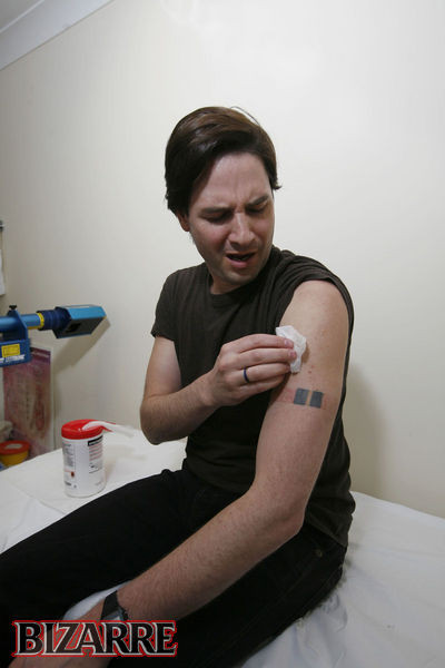 Qua thời gian, tần suất cũng như lượng nọc độc được tiêm vào ngày càng cao. Tuy nhiên, Steve không thể tránh khỏi sơ sót và đã nhiều lần phải nhập viện điều trị.